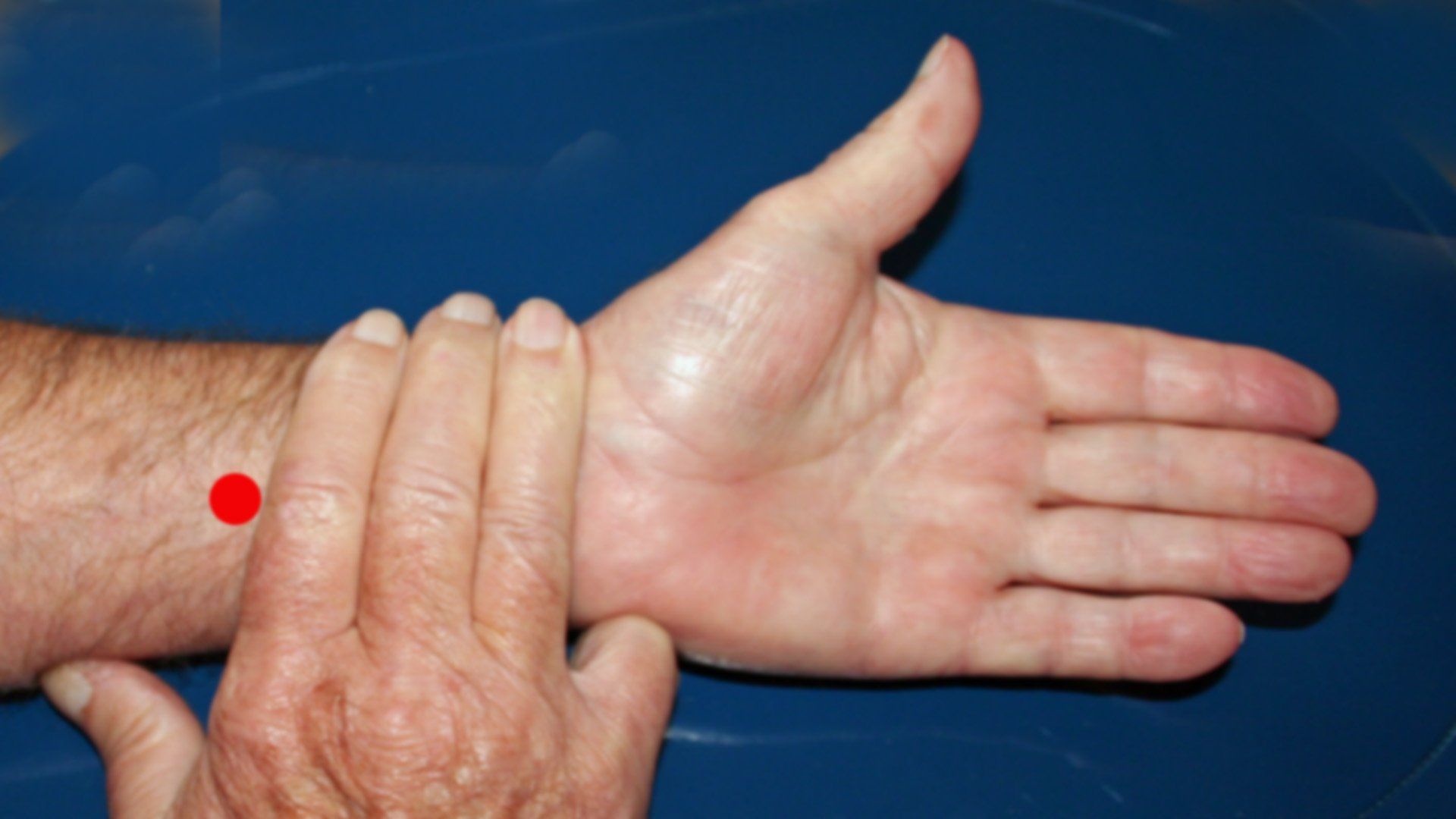 So misst man die Lage der Armbänder aus.