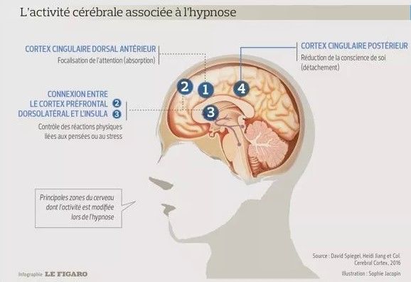 Hypnose Lyon fonctionnement cerveau hypnothérapie lyon Hypnose Ericksonienne Lyon 3