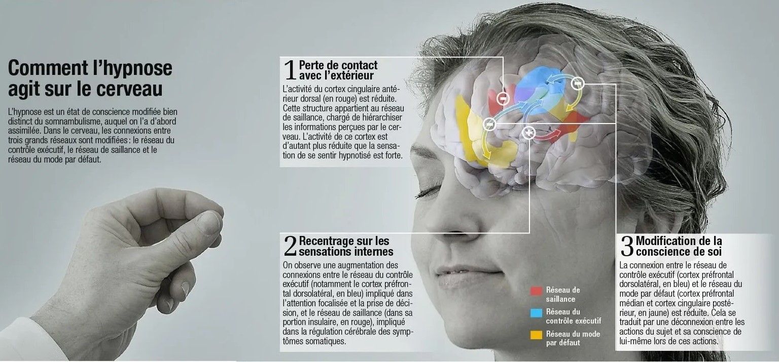 Hypnose Lyon fonctionnement cerveau hypnothérapie lyon Hypnose Ericksonienne Lyon 3 Hypnose Thérapeutique médicale conversationnelle