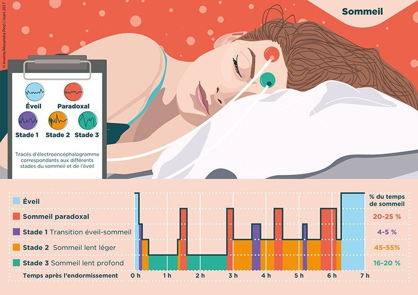 Inserm stades sommeil cycles sommeil dormir rêver Hypnose Lyon