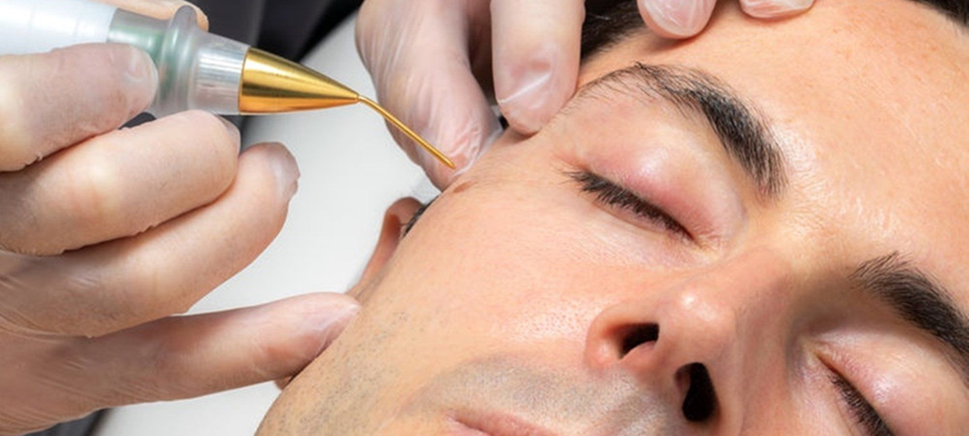 123RF Karel Joseph Noppe Brooks anti-aging gesichtbehandlung mit hotplasma hotplasmaberlin faltenberlin faltenbehandlungberlin antiagingberlin kosmetikberlin kosmetikstudioberlin kosmetikbehandlungenberlin gesichtbehandlungenberlin