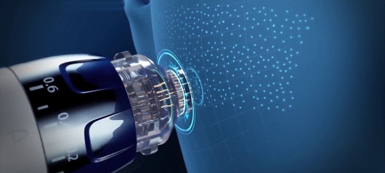 Eunsung Global anti-aging gesichtbehandlung mit epnmicroneedling epnmicroneedlingberlin elektroporationberlin microneedlingliftingberlin faltenberlin faltenbehandlungberlin antiagingberlin kosmetikberlin kosmetikstudioberlin kosmetikbehandlungenberlin gesichtbehandlungenberlin