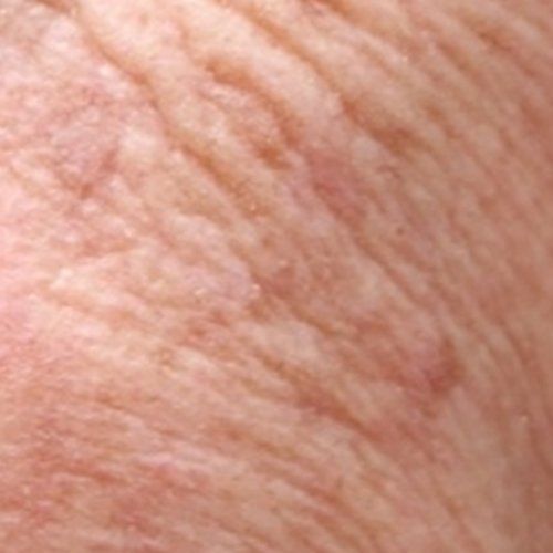 falten hautproblem faltenberlin hautproblemeberlin kosmetikberlin kosmetikstudioberlin kosmetikreinickendorf kosmetikstudioreinickendorf