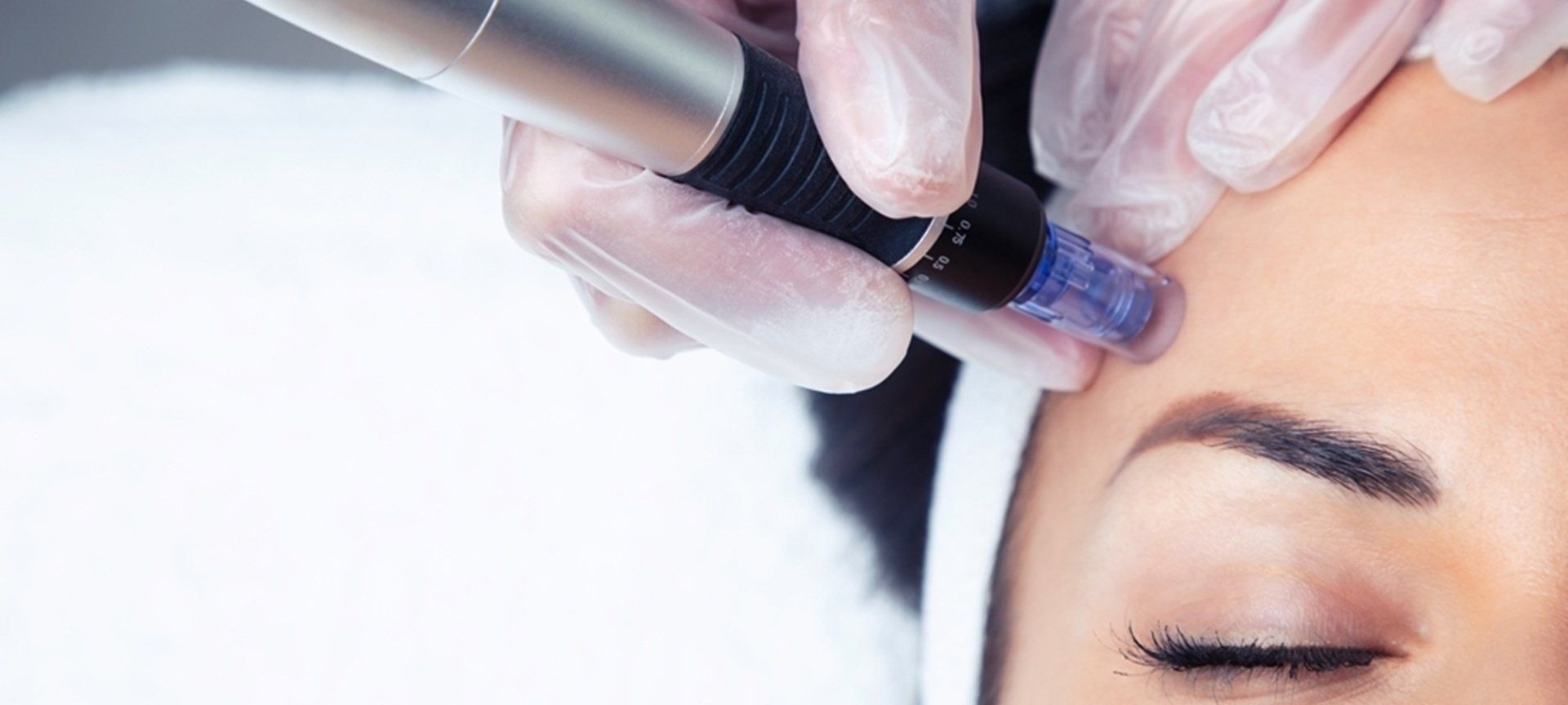 Shutterstock Josep Suria anti-aging gesichtbehandlung mit microneedling microneedlingberlin faltenberlin faltenbehandlungberlin antiagingberlin kosmetikberlin kosmetikstudioberlin kosmetikbehandlungenberlin gesichtbehandlungenberlin