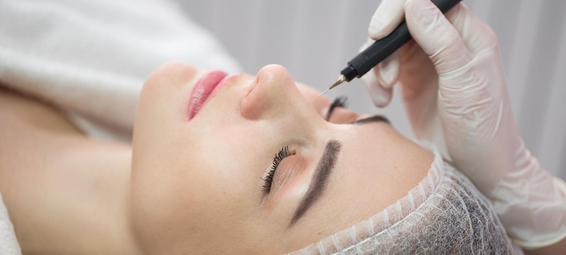 Minari verschluss von roten Äderchen mittels radiothermolyse roteäderchenberlin couperoseberlin teleangiektasieberlin kosmetikstudioberlin kosmetikbehandlungenberlin gesichtbehandlungenberlin