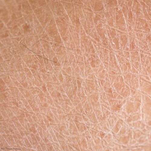 trockene haut im gesicht trockenehautberlin kosmetikberlin kosmetikstudioberlin kosmetikreinickendorf kosmetikstudioreinickendorf