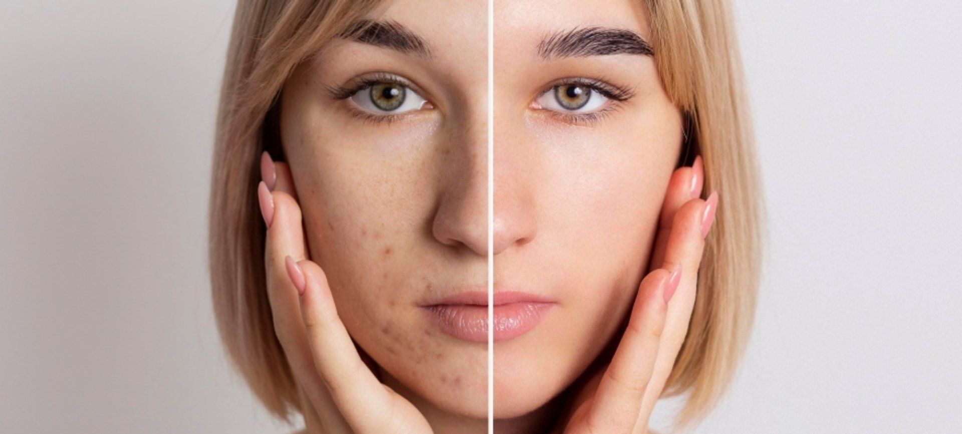 Freepik Premium unreinehaut in berlin unreinehautberlin akneberlin pickelberlin hautreinigungberlin hautproblemeberlin kosmetikberlin kosmetikstudioberlin kosmetikreinickendorf kosmetikstudioreinickendorf
