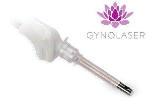 Gynolaser vaginal CO2 Rejuvenecimiento vaginal Málaga laser CO2