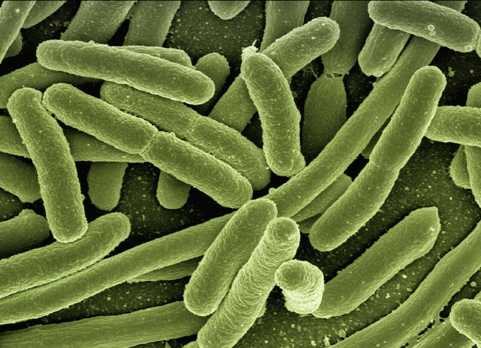 Lactobacillus acidophilus Lactobacillus acidophilus immune support help