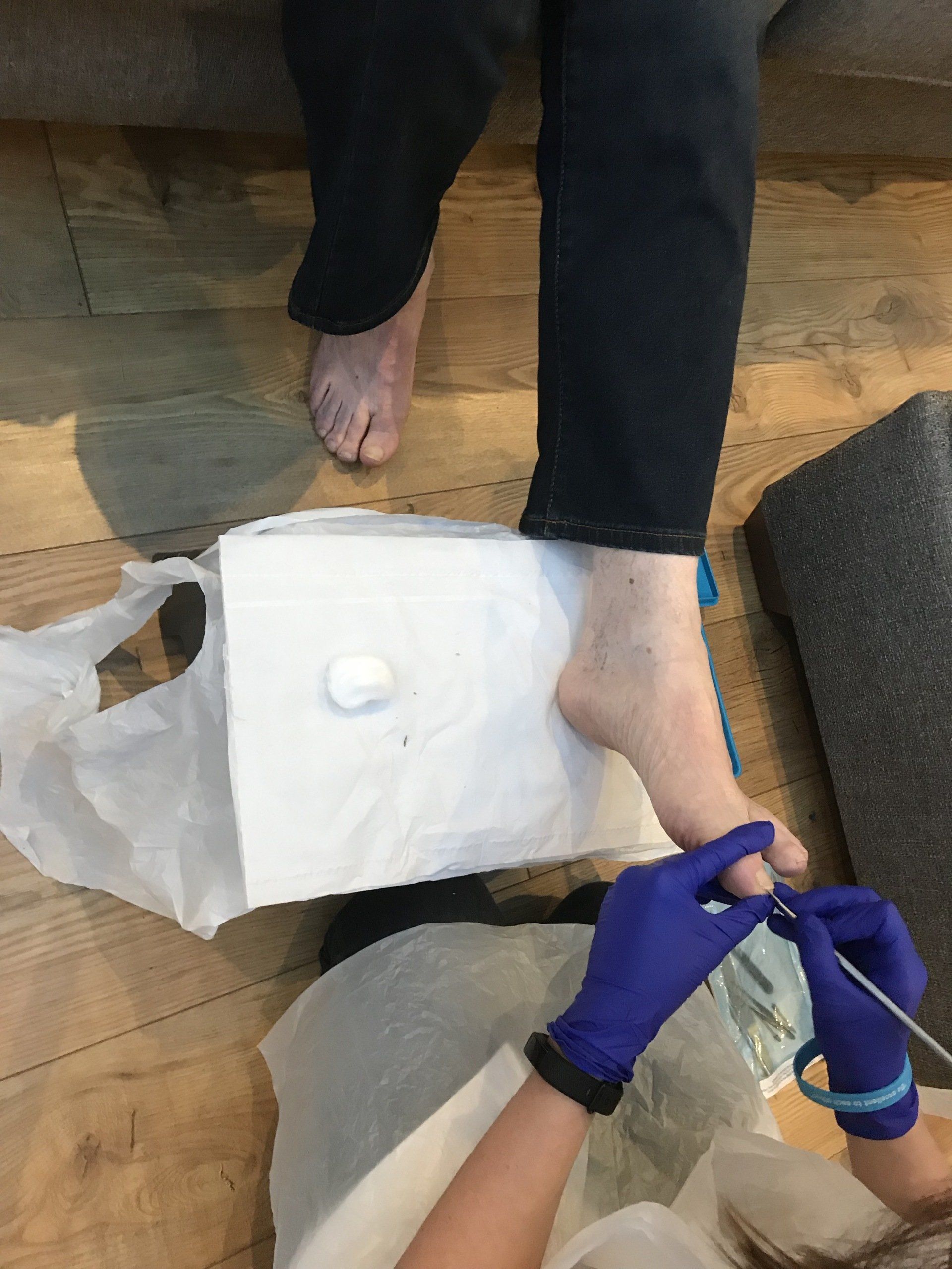 Bournemouth Footcare treatment