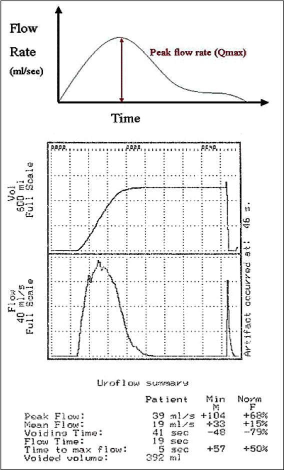 Normal Flow rate