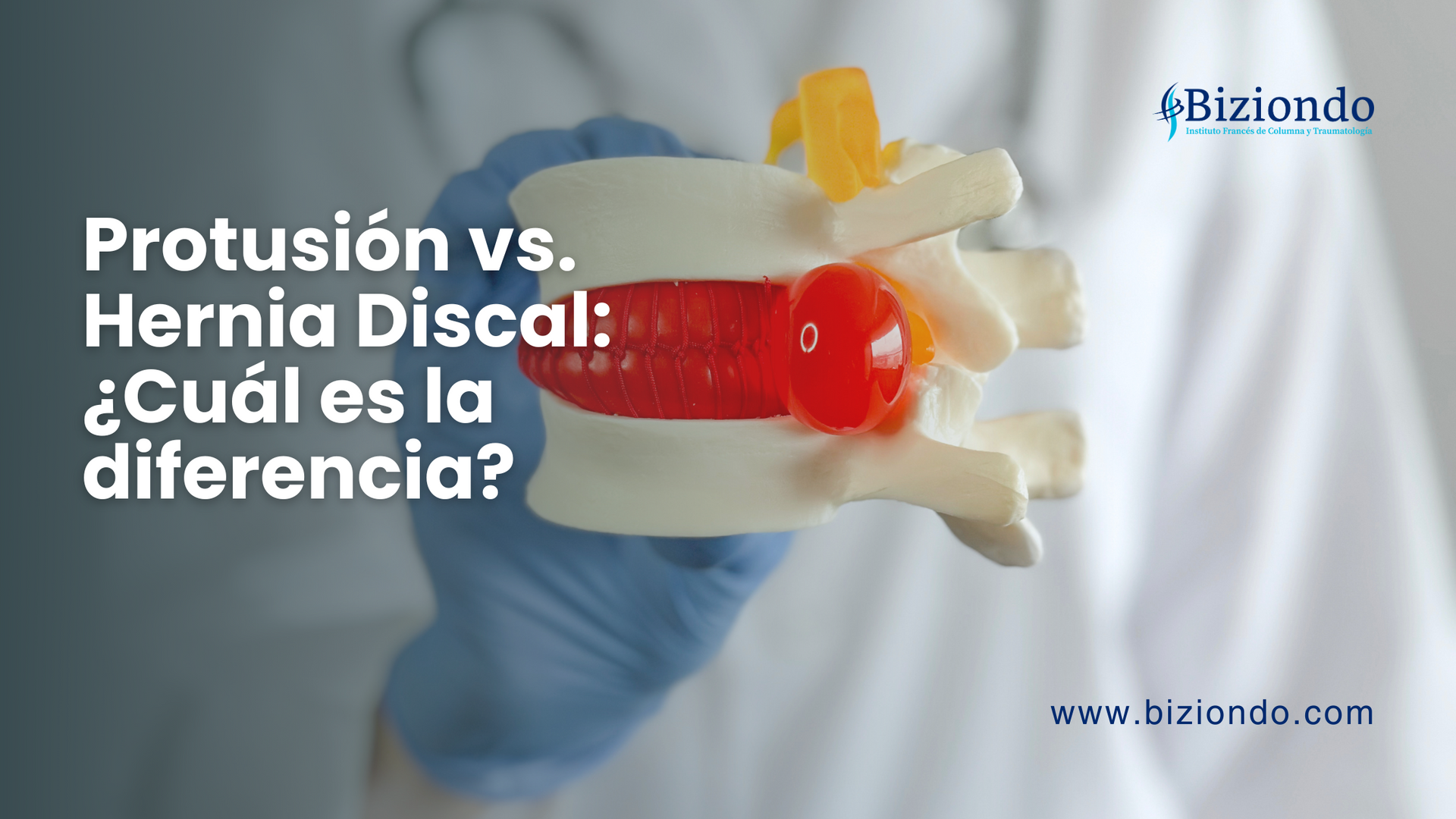 Modelo anatómico de una columna vertebral con una protusión y hernia discal, sostenido por un médico