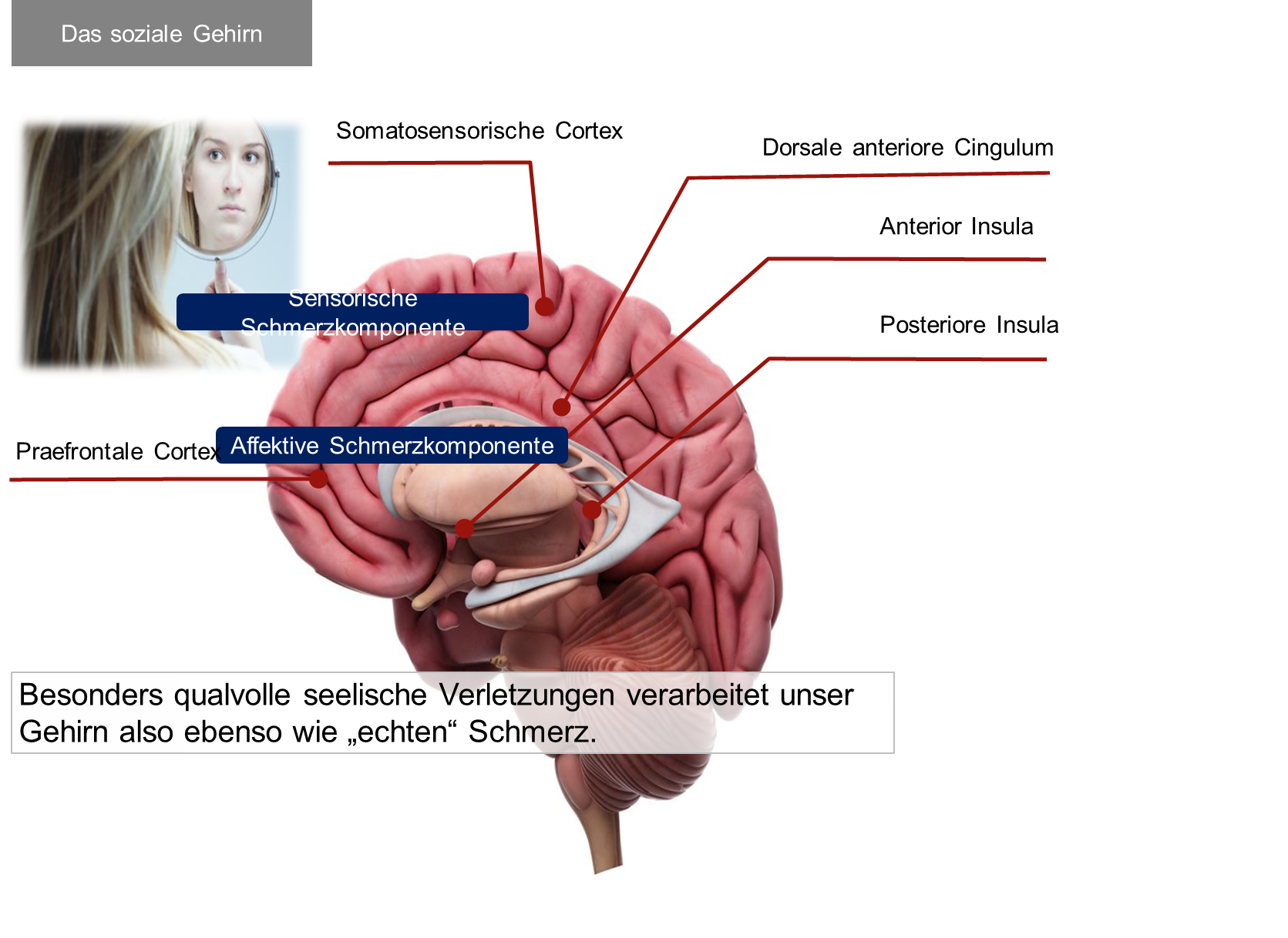 Bild einer Längshälfte eines Gehirns, Schmerzentren werden darstellt als Symbol von dauerhaftem Stress.