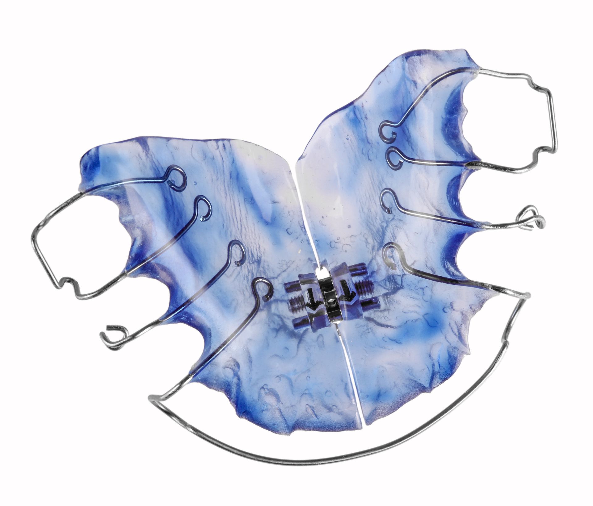 Herausnehmbare Zahnspange