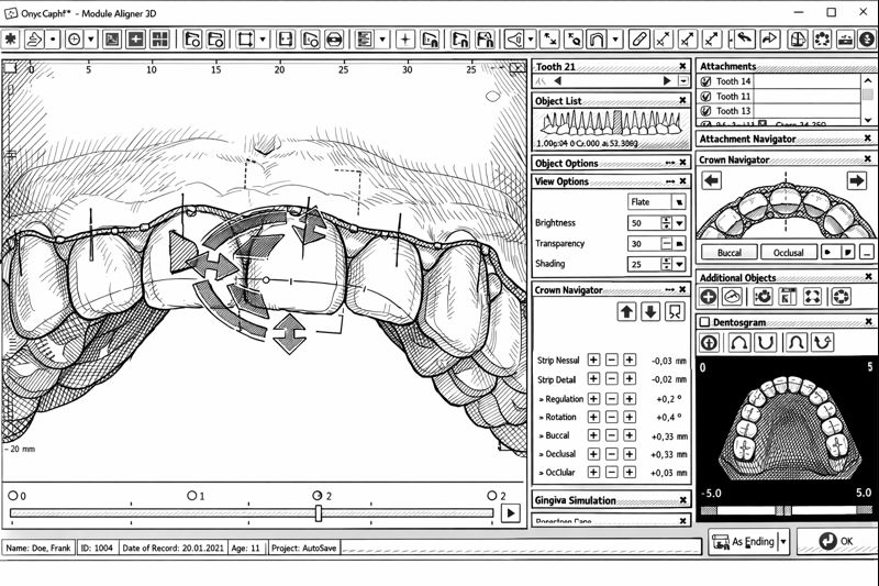 3D Set-Up Kieferorthopädie
