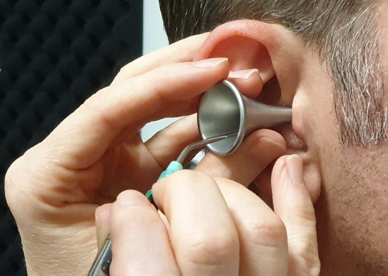 Ear wax removal by microsuction