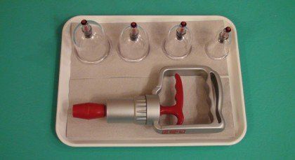 Schröpfgläser Schröpfgläser