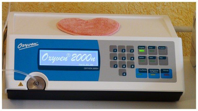 intravenöse Sauerstofftherapie - Oxyvenierung intravenöse Sauerstofftherapie - Oxyvenierung