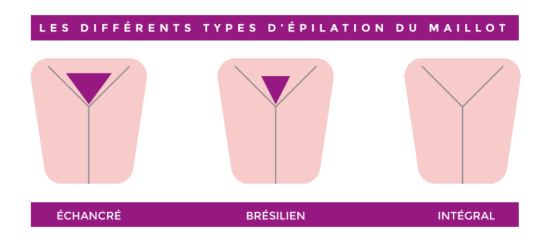 epilation des aisselles Milie S'thétique