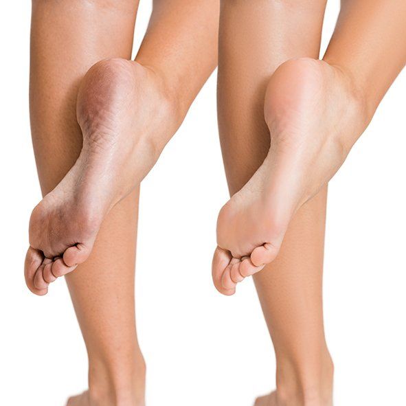 Wellness Pedicure in Hales Corners Wisconsin
