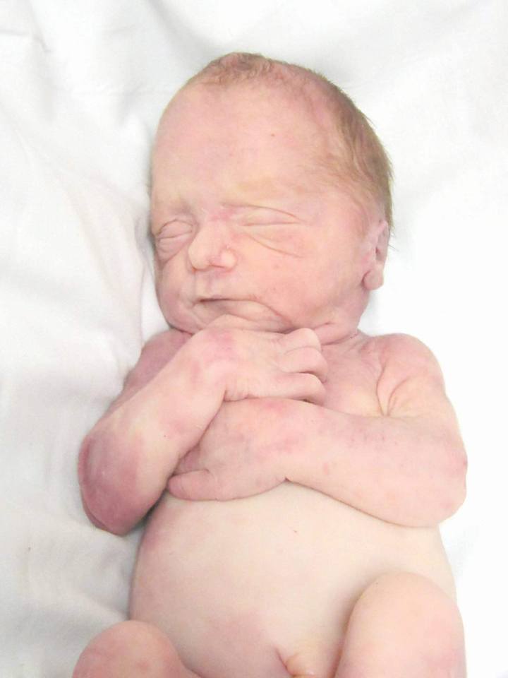 Angel Gowns, Infant Loss