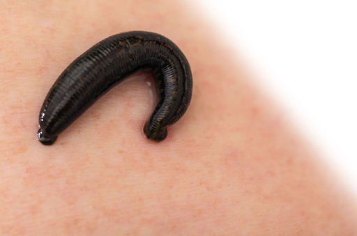 Blutegeltherapie Blutegeltherapie in Winnenden