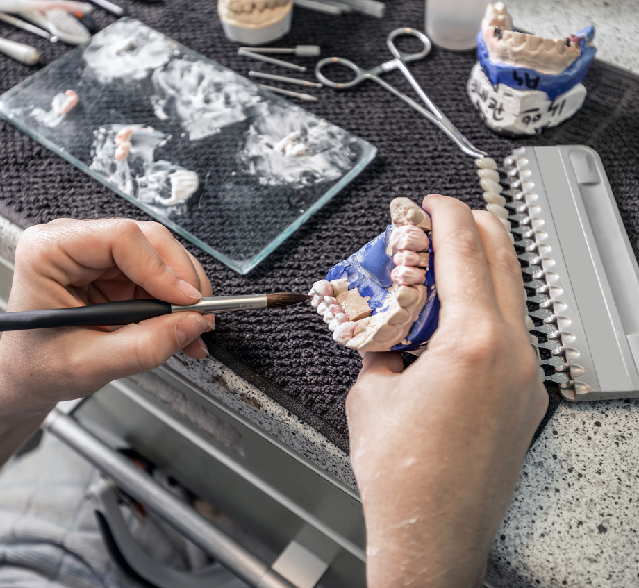 Soluciones dentales, prótesis dentales, laboratorio B1 DENT Castellón, España, soluciones estéticas y duraderas.