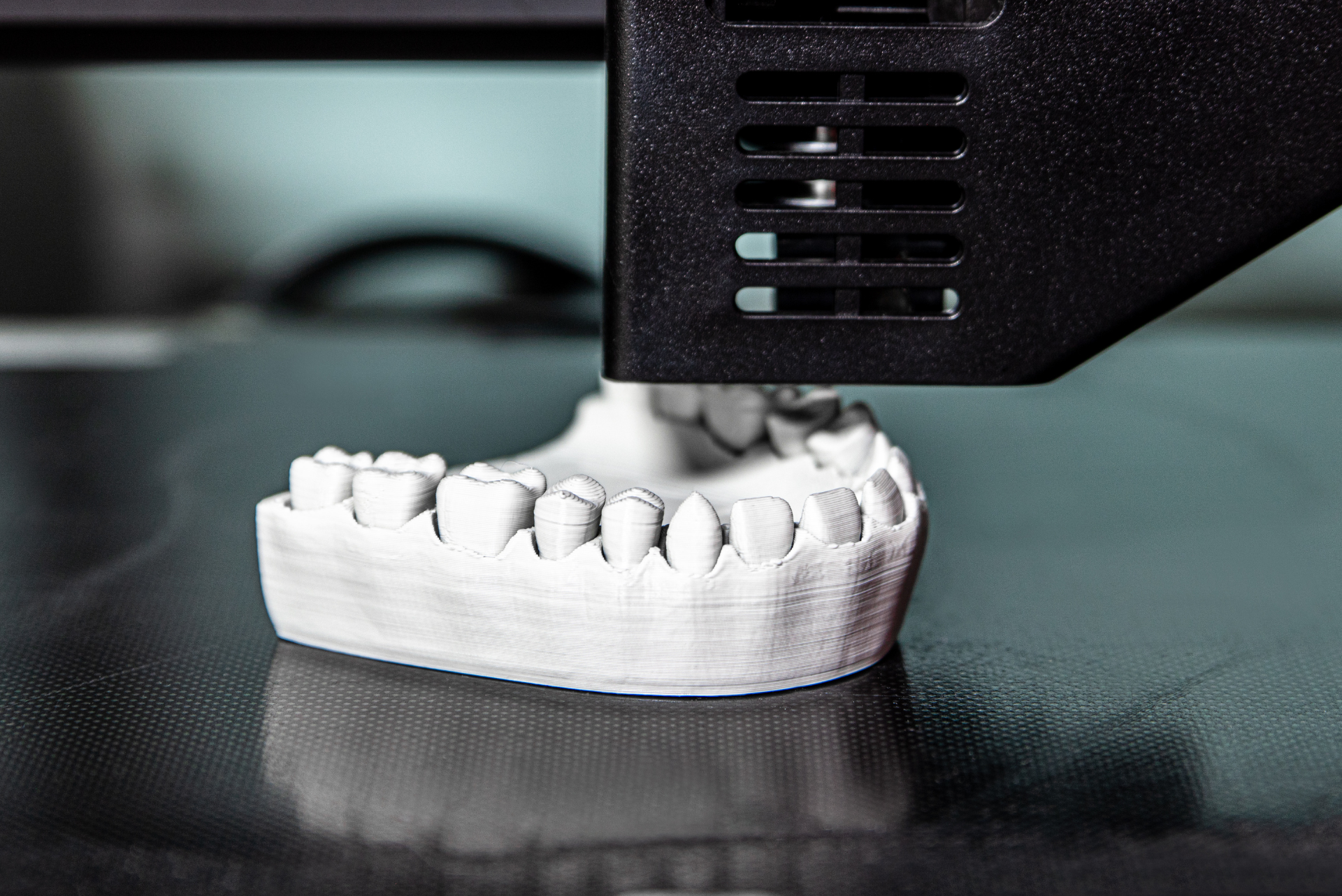 Soluciones dentales, prótesis dentales, laboratorio B1 DENT Castellón, España, soluciones estéticas y duraderas.