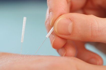 Akupunktur01