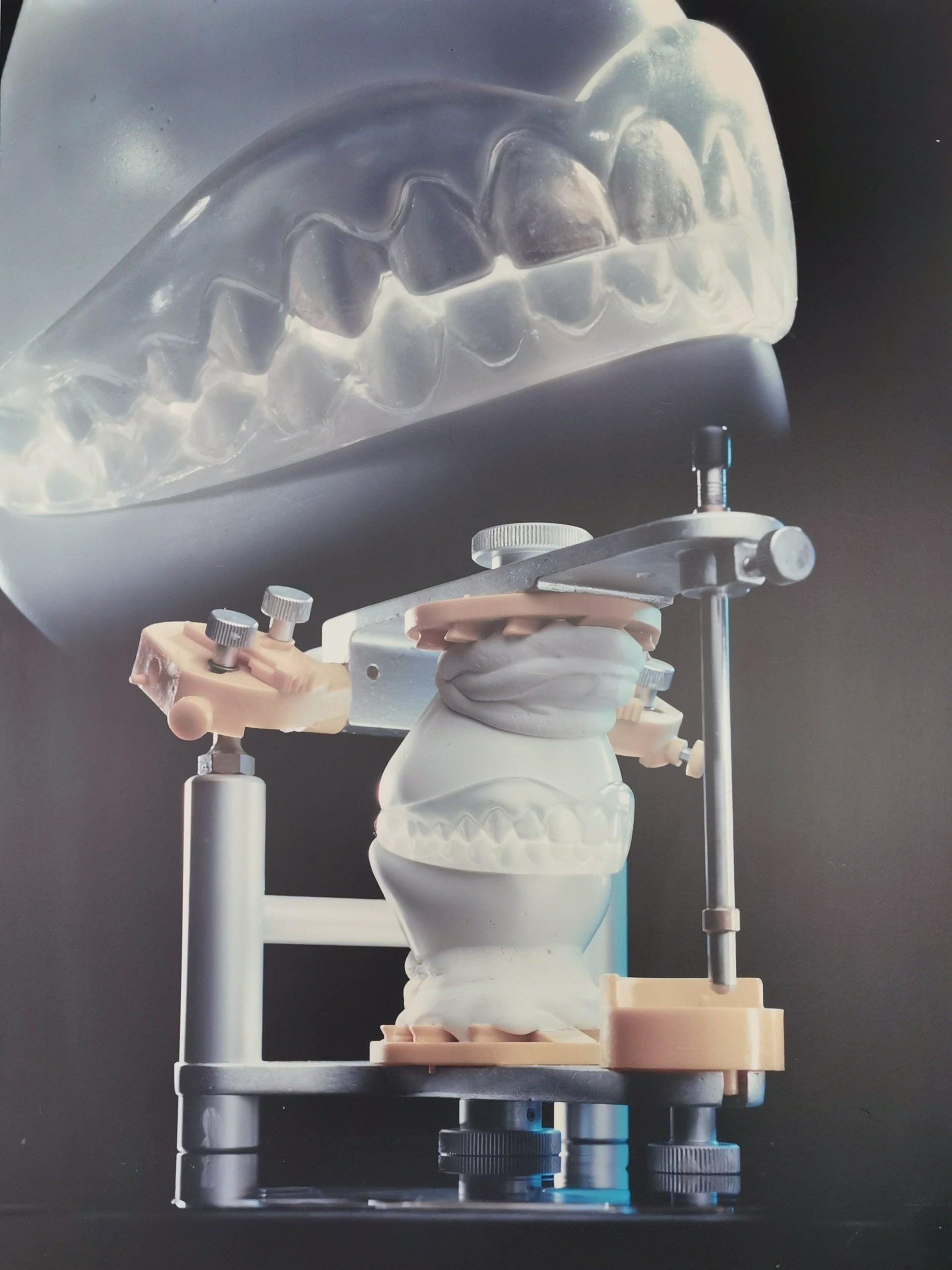 Positioner Peter Brög GmbH, Positioner