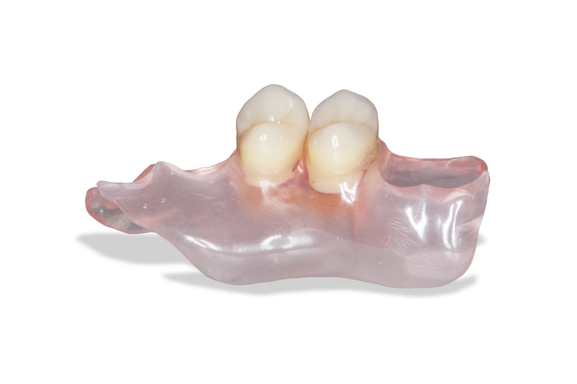 Clearsplint Provisorium, Angenehmer tagekompfor