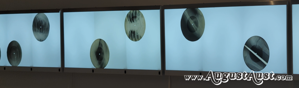 Schallplatten aus Röntgenbilder. Foto: August Aust Schallplatten aus Röntgenbilder. Foto: August Aust