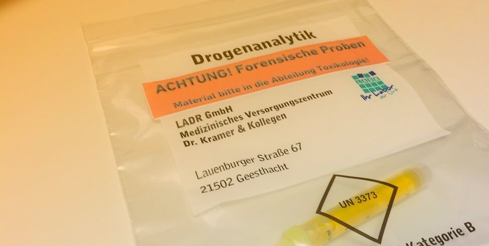 Abstinenzkontrollprogramm zur MPU