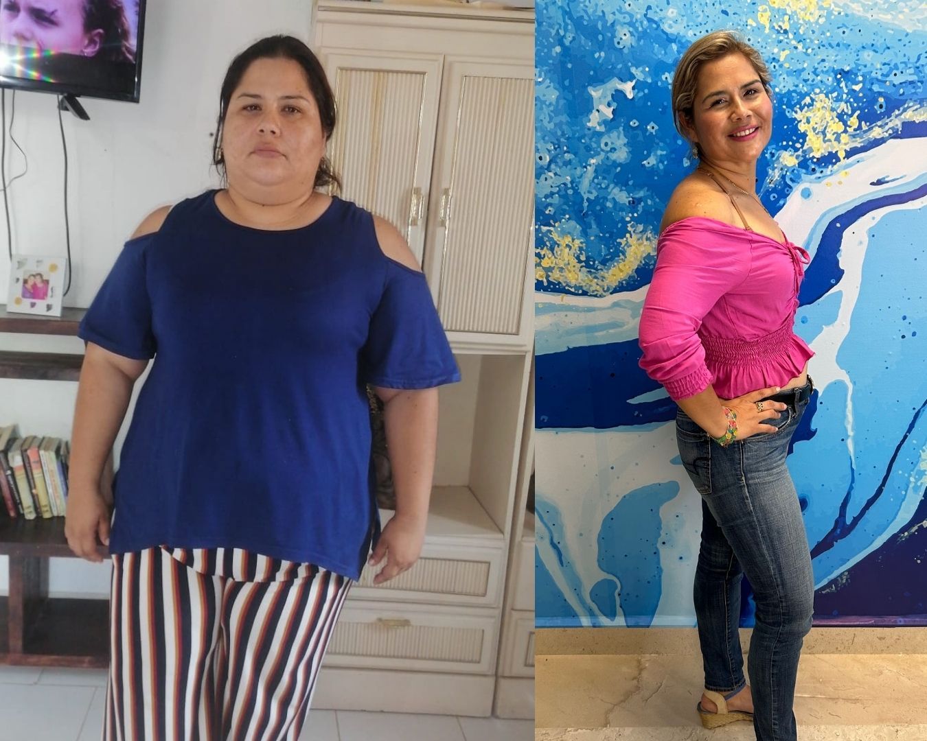 Costos Cirugía Bariátrica en Ciudad de México