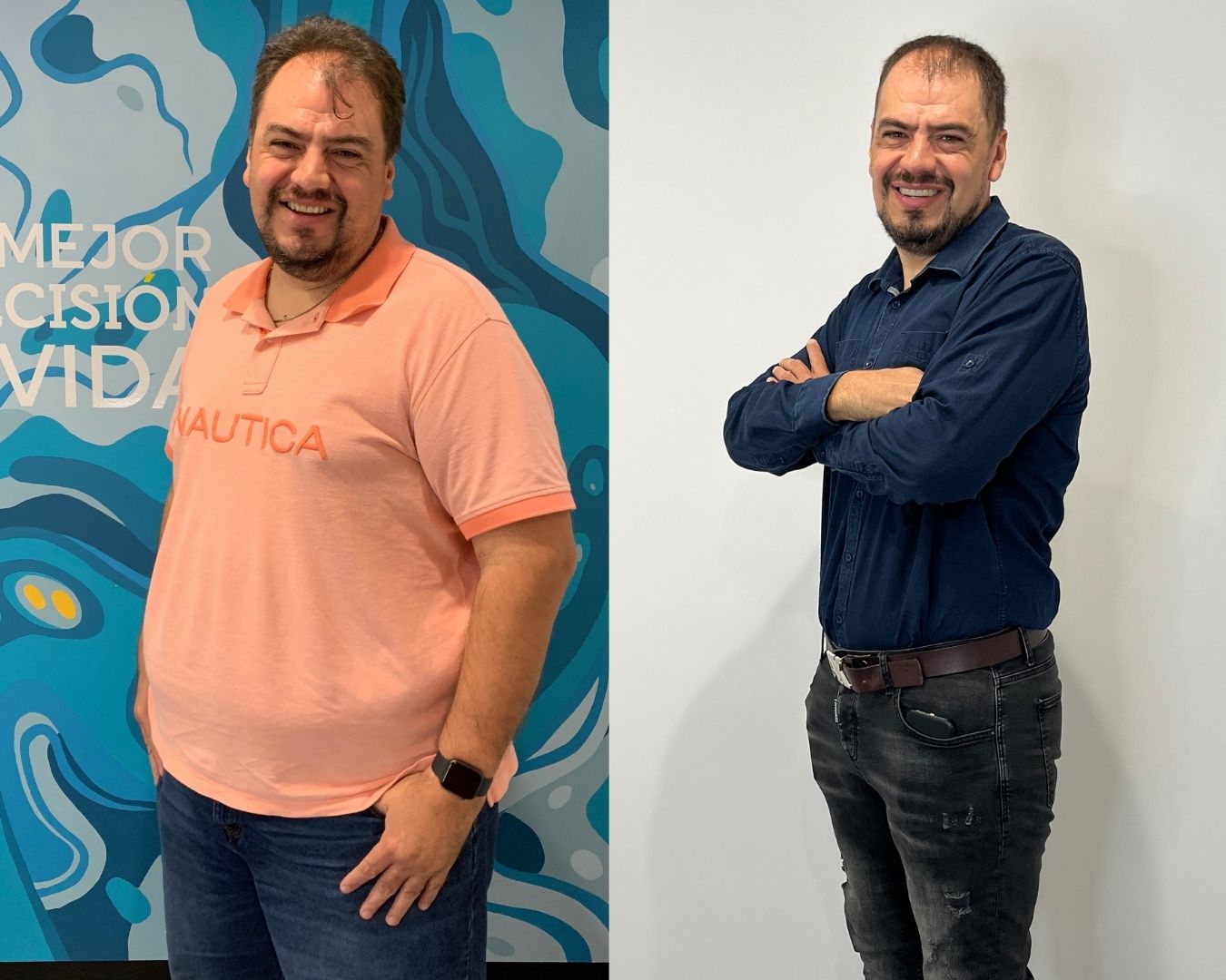 Costos Cirugía Bariátrica en Ciudad de México