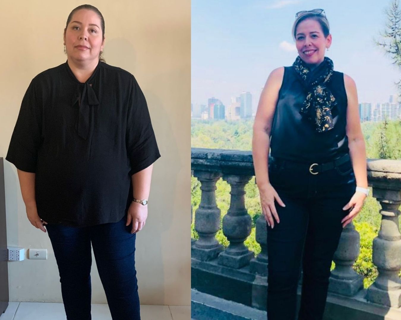 Costos Cirugía Bariátrica en Ciudad de México