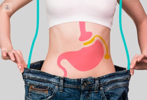 Obésité / Chirurgie bariatrique