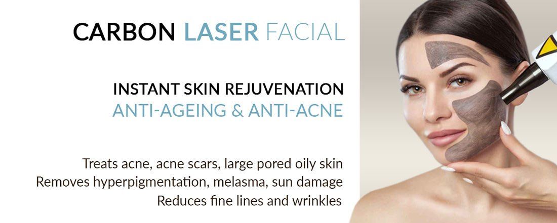 Carbon laser facial peel