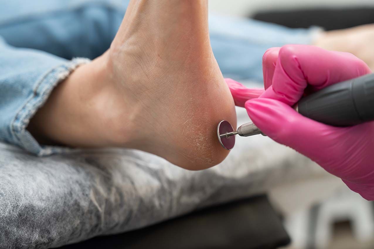 Medizinische Fußpflege für glückliche Füße