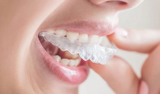 Ortodoncia Ortodoncia