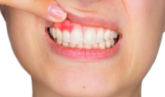 Periodoncia Periodoncia