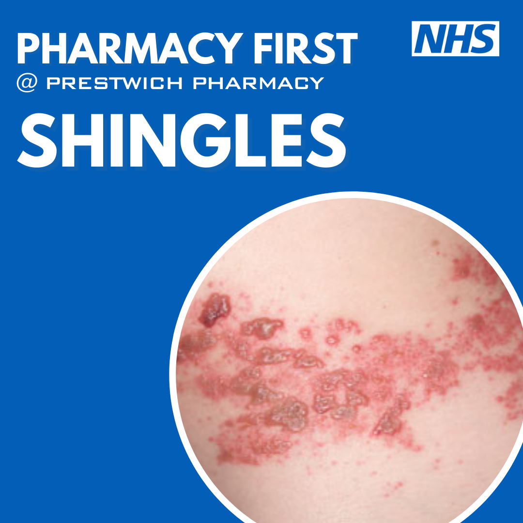 shingles rash