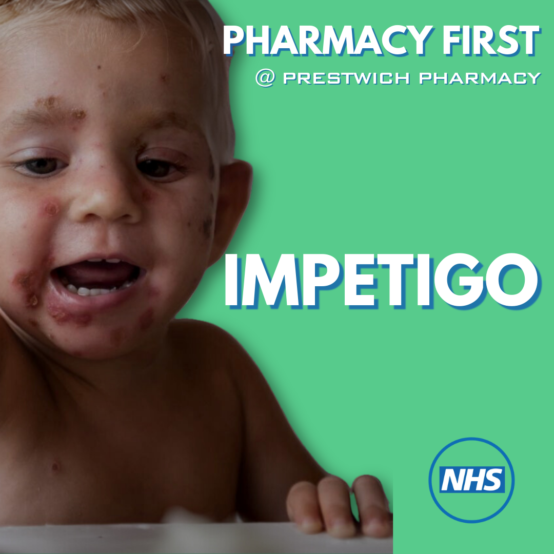 baby with impetigo on face