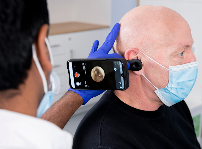 EAR MICRO SCUTION WAX TYMPAHEALTH