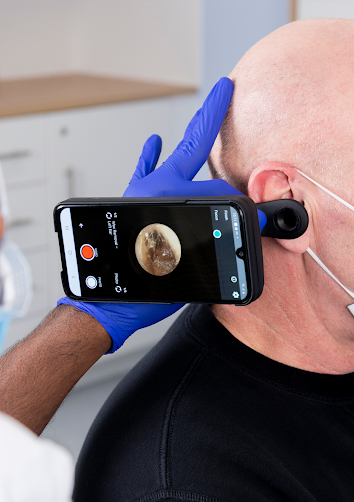 microsuction demonstration