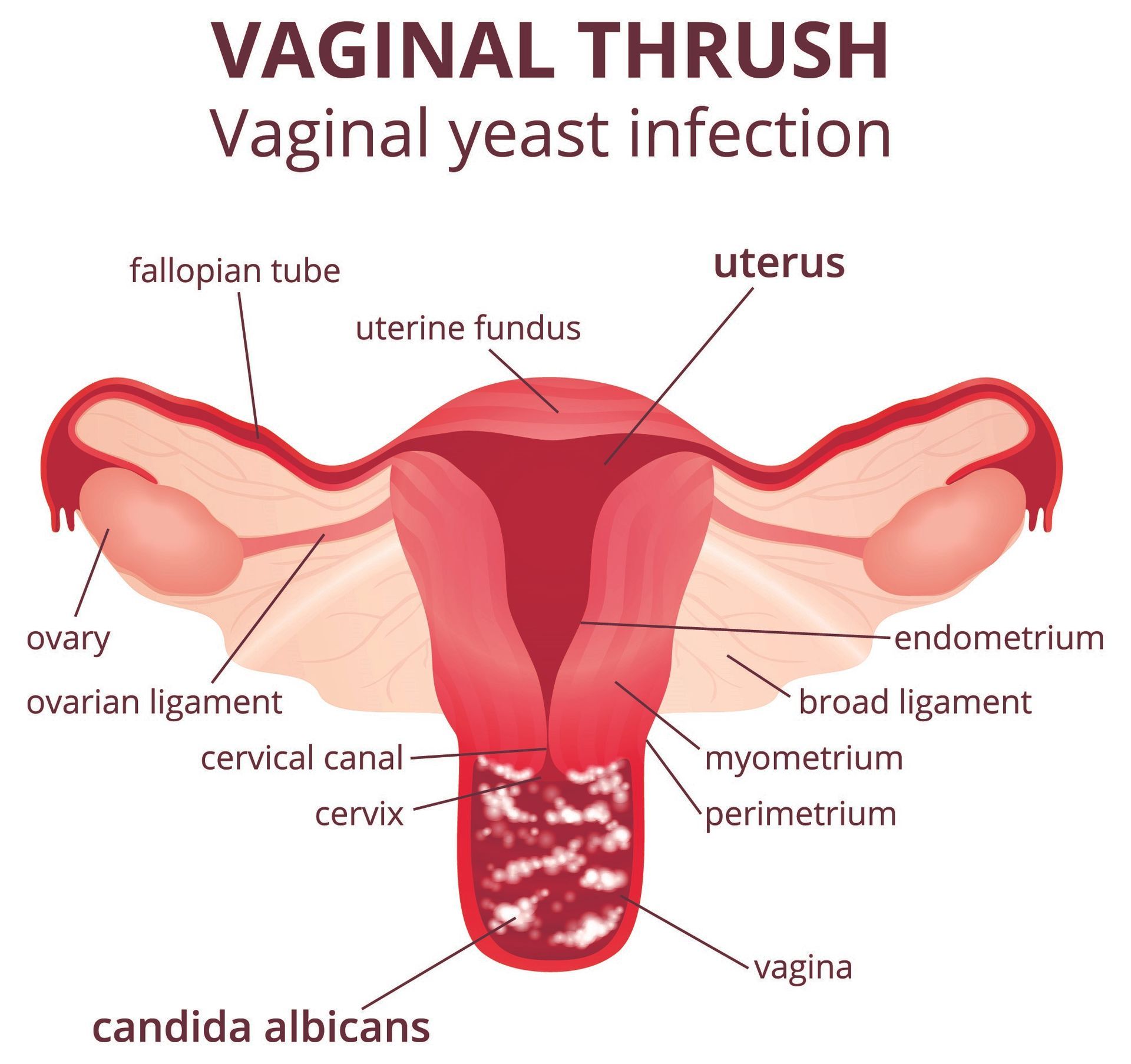diagram of uterus