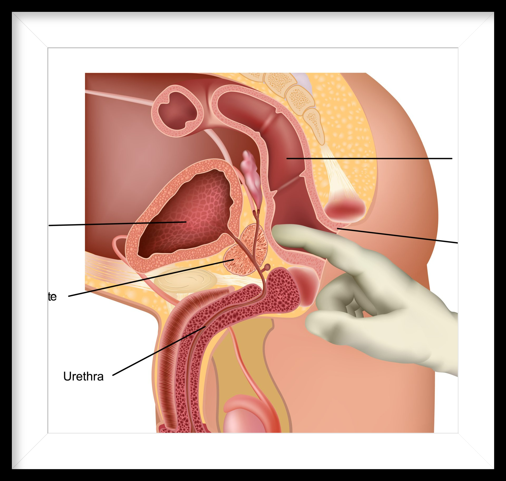 PROSTATE MASSAGE