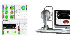 Topographie pentacam