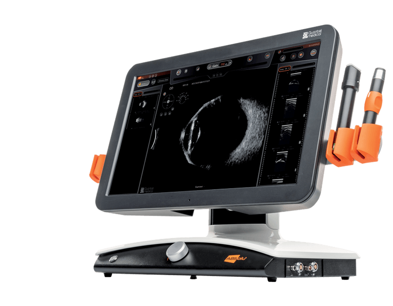 ECHOGRAPHIE OCULAIRE B UBM