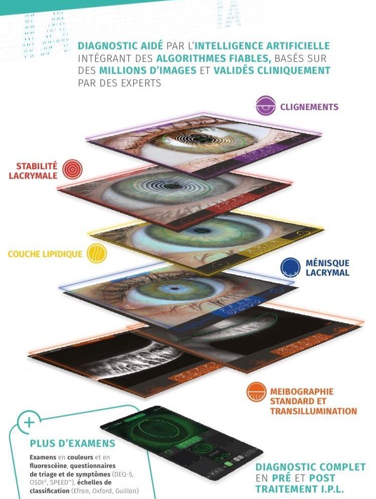 Plateforme d'imagerie de sècheresse oculaire C Diag
